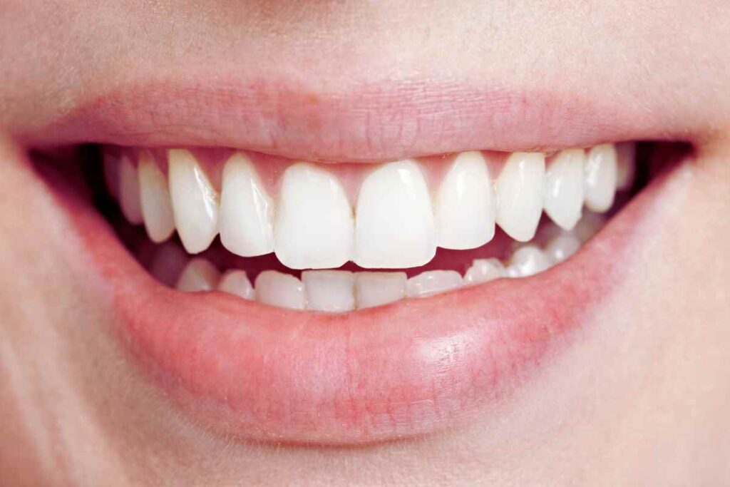 denti bianchissimi: mi fanno tutti i complimenti