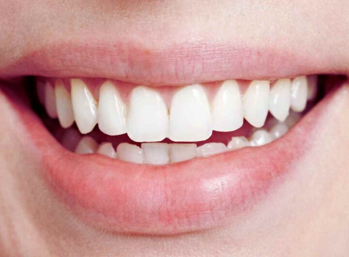 denti bianchissimi: mi fanno tutti i complimenti